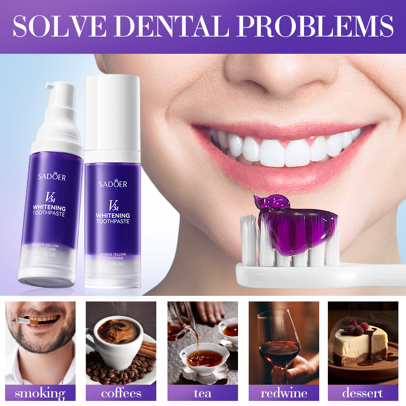Teeth Whitening Hismile - SADOER V34 Daha Parlak Dişler için