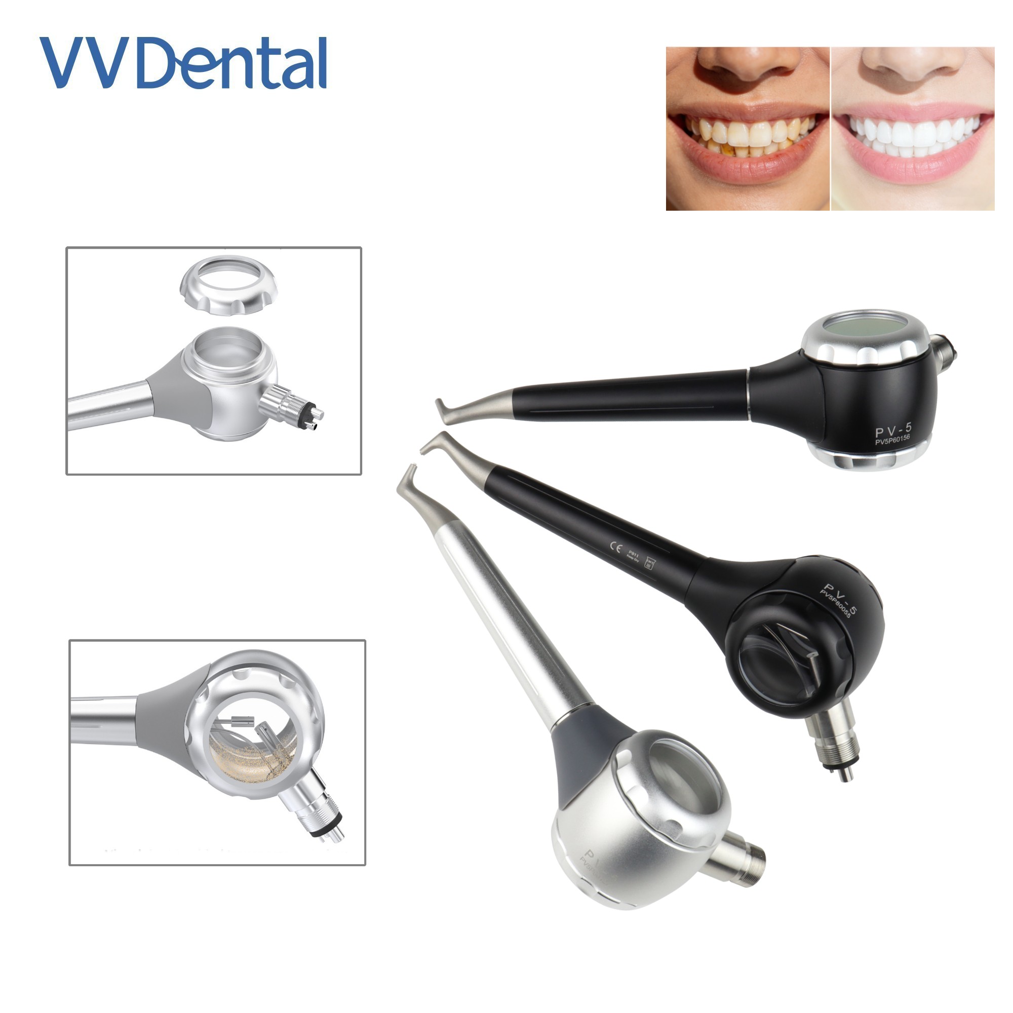 Teeth Whitening China - VV Dental 2/4 Delikli Diş Beyazlatma