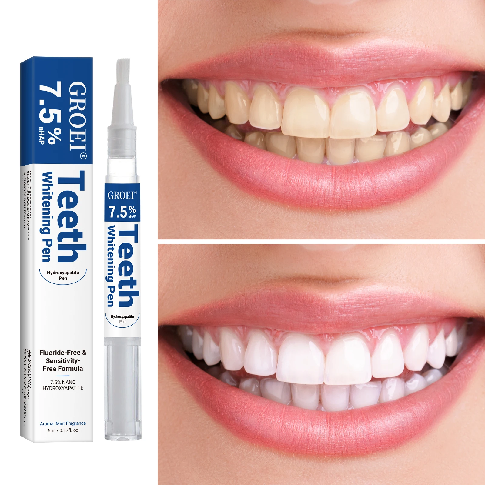Hidroksiapatit Diş Beyazlatma  - Teeth Whitening Hismile incelemesi ve fiyatı