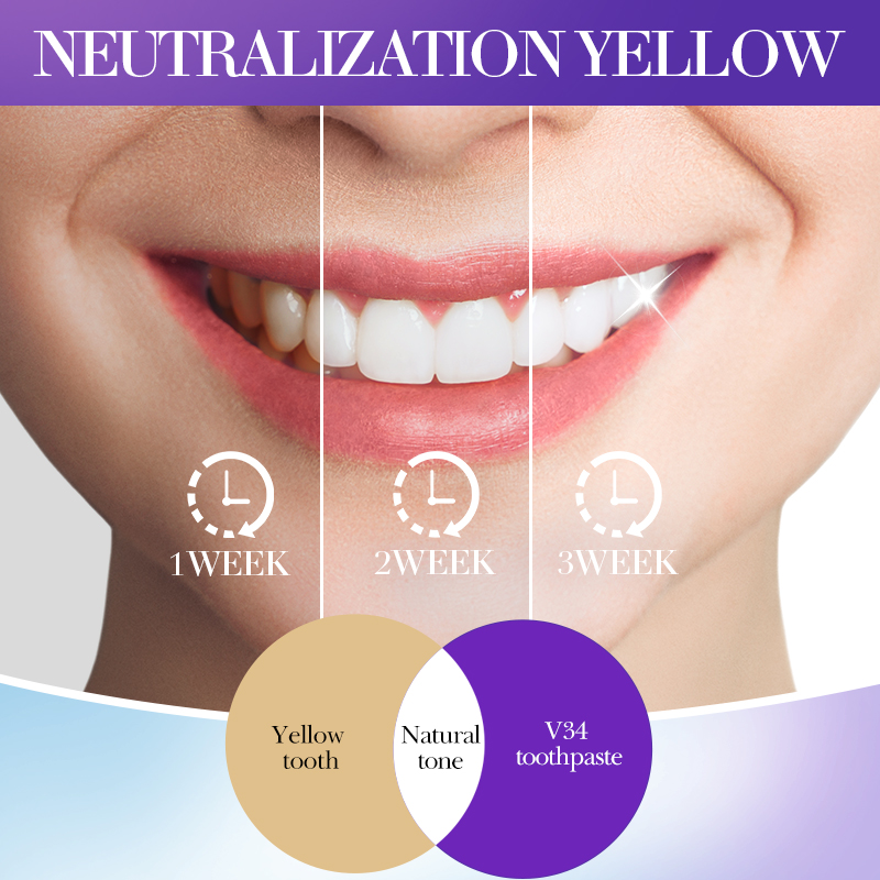 SADOER V34 Daha Parlak Dişler  - Teeth Whitening Hismile incelemesi ve fiyatı