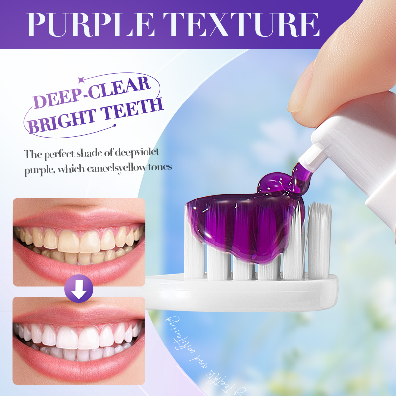 SADOER V34 Daha Parlak Dişler  - Teeth Whitening Hismile incelemesi ve fiyatı