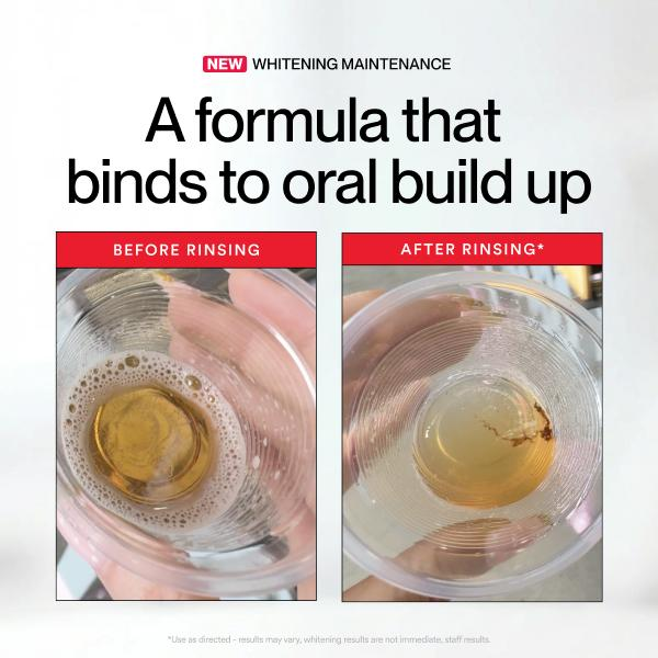 Hismile ID Beyazlatıcı Leke Gi - Teeth Whitening Hismile incelemesi ve fiyatı
