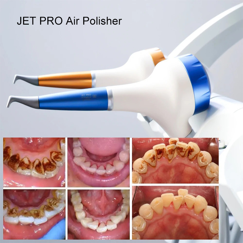 VV Dental Hava Parlatma Prophy - Teeth Whitening China incelemesi ve fiyatı