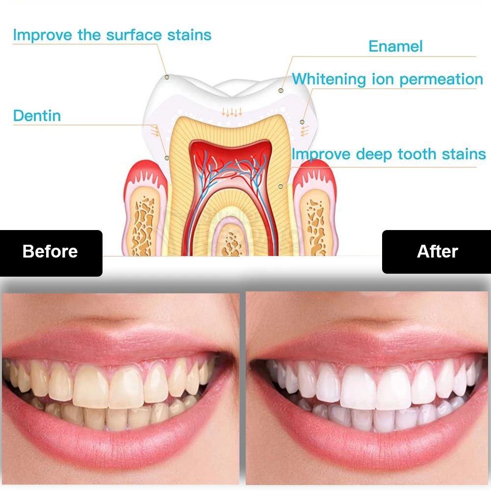 Diş Diş Beyazlatma Kiti Mini 1 - Teeth Whitening Blue Light incelemesi ve fiyatı