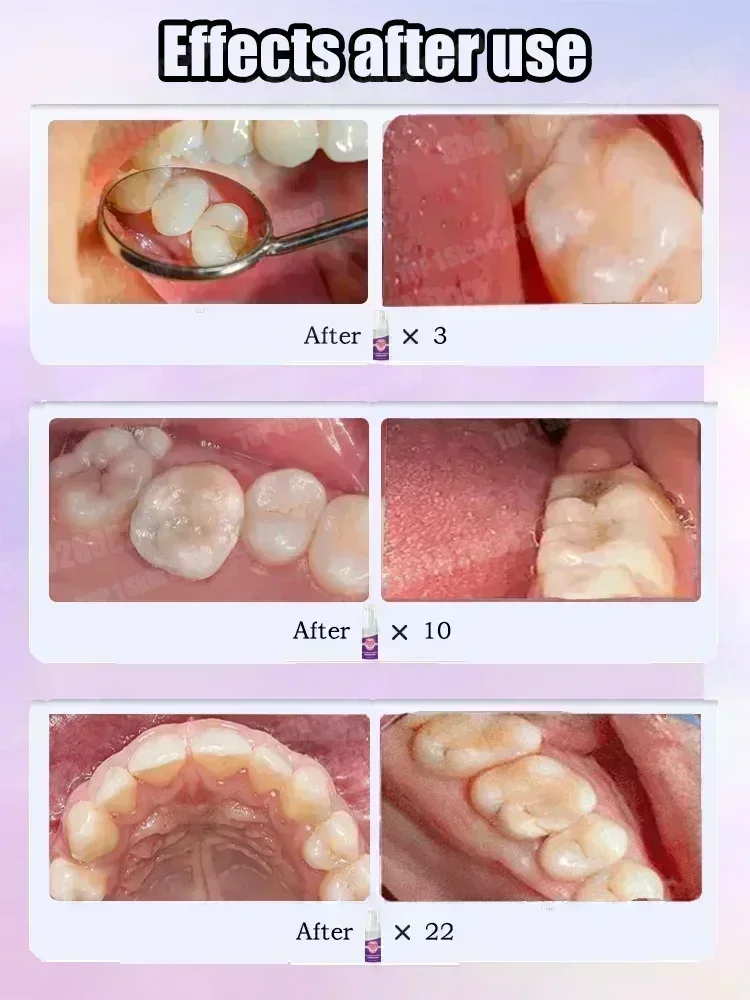 Sıcak satışlar En çok satan, B - Teeth Whitening Cream incelemesi ve fiyatı