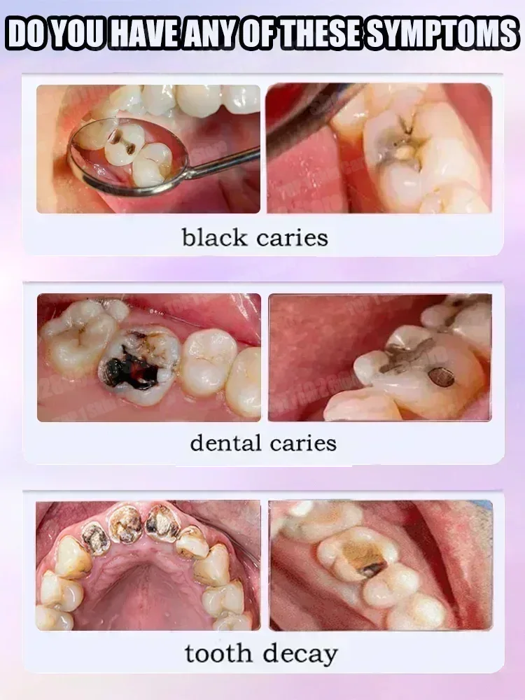 Sıcak satışlar En çok satan, B - Teeth Whitening Cream incelemesi ve fiyatı